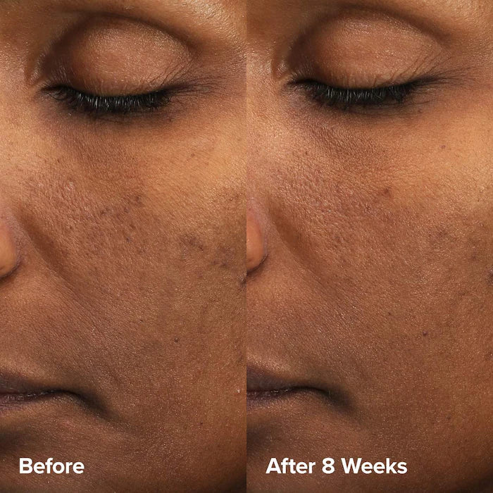 Paula's Choice Skin Perfecting 6% Mandelic Acid + 2% Lactic Acid Liquid Exfoliant 88 ml