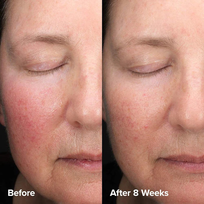 Paula's Choice Skin Perfecting 6% Mandelic Acid + 2% Lactic Acid Liquid Exfoliant 88 ml