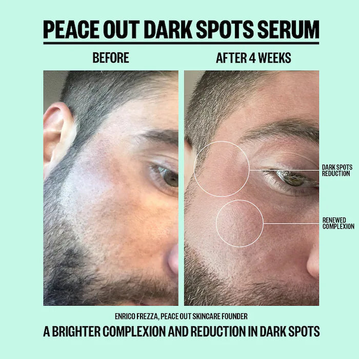 Peace Out Dark Spots Serum 30 ml