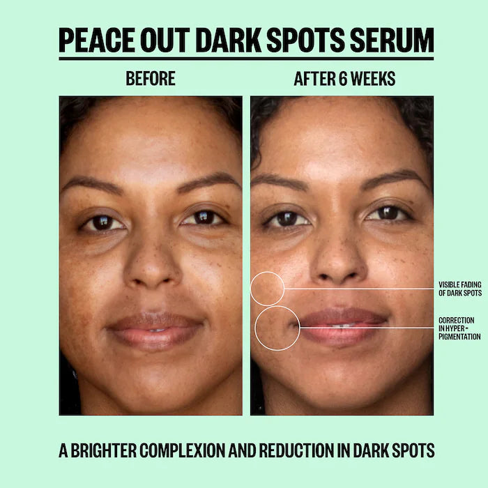 Peace Out Dark Spots Serum 30 ml