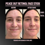 Peace Out Retinol Face Stick 8 g