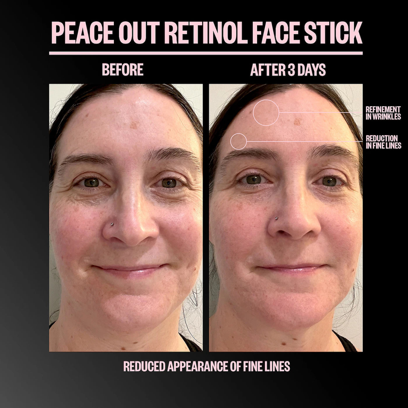 Peace Out Retinol Face Stick 8 g