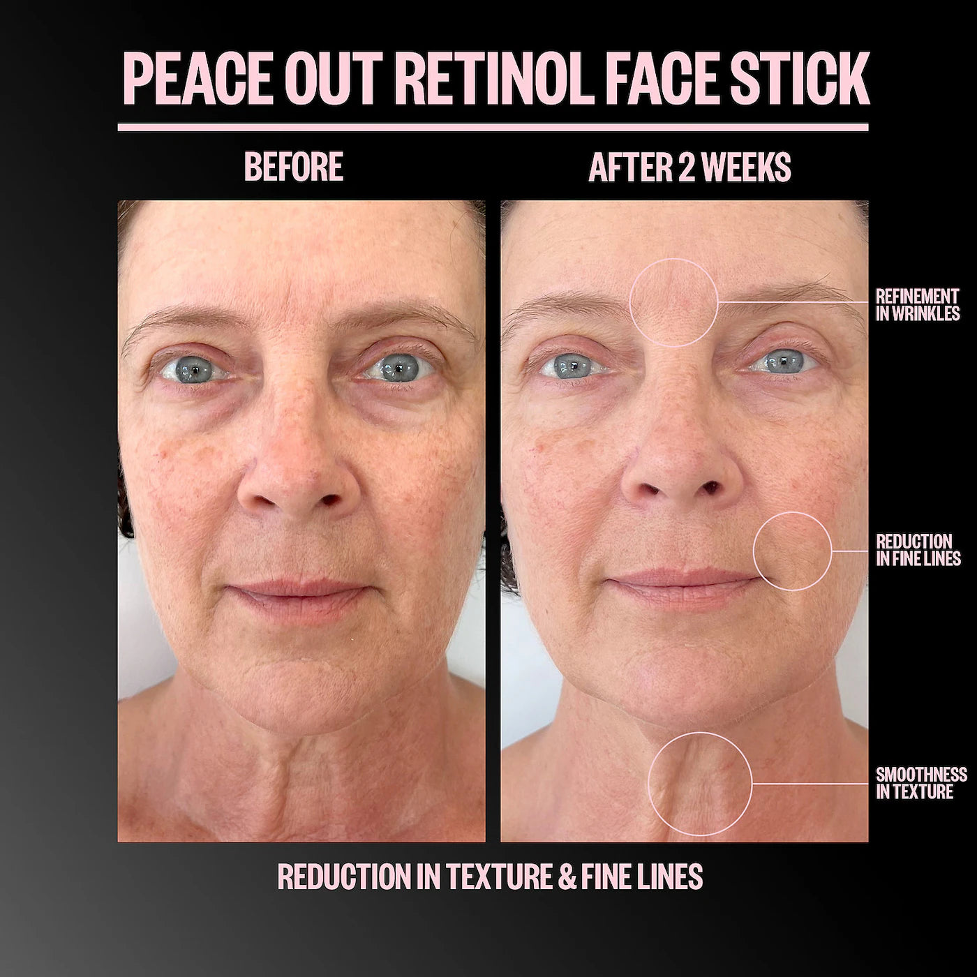 Peace Out Retinol Face Stick 8 g