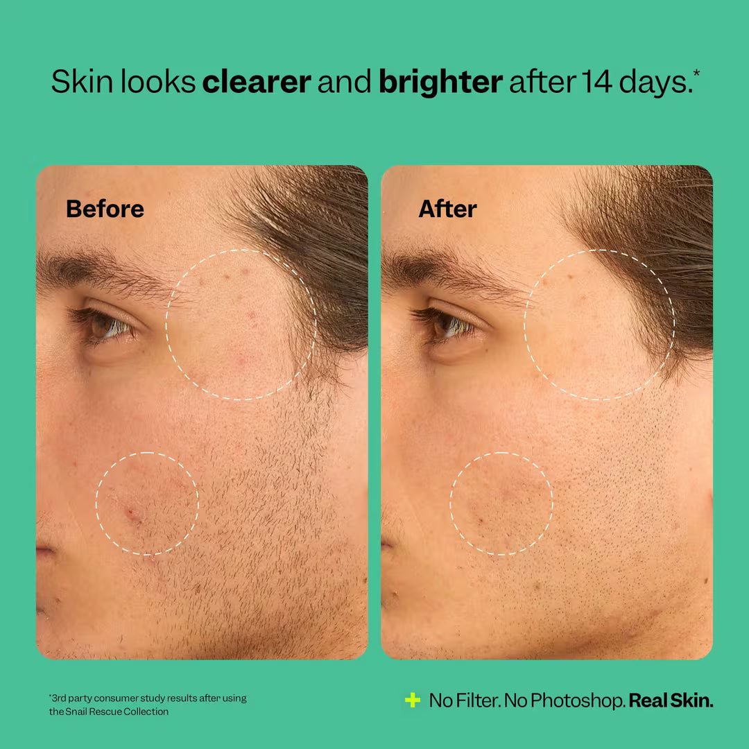 Peach Slices Snail Rescue Blemish Busting Toner Mini 30 ml / 1.0 oz