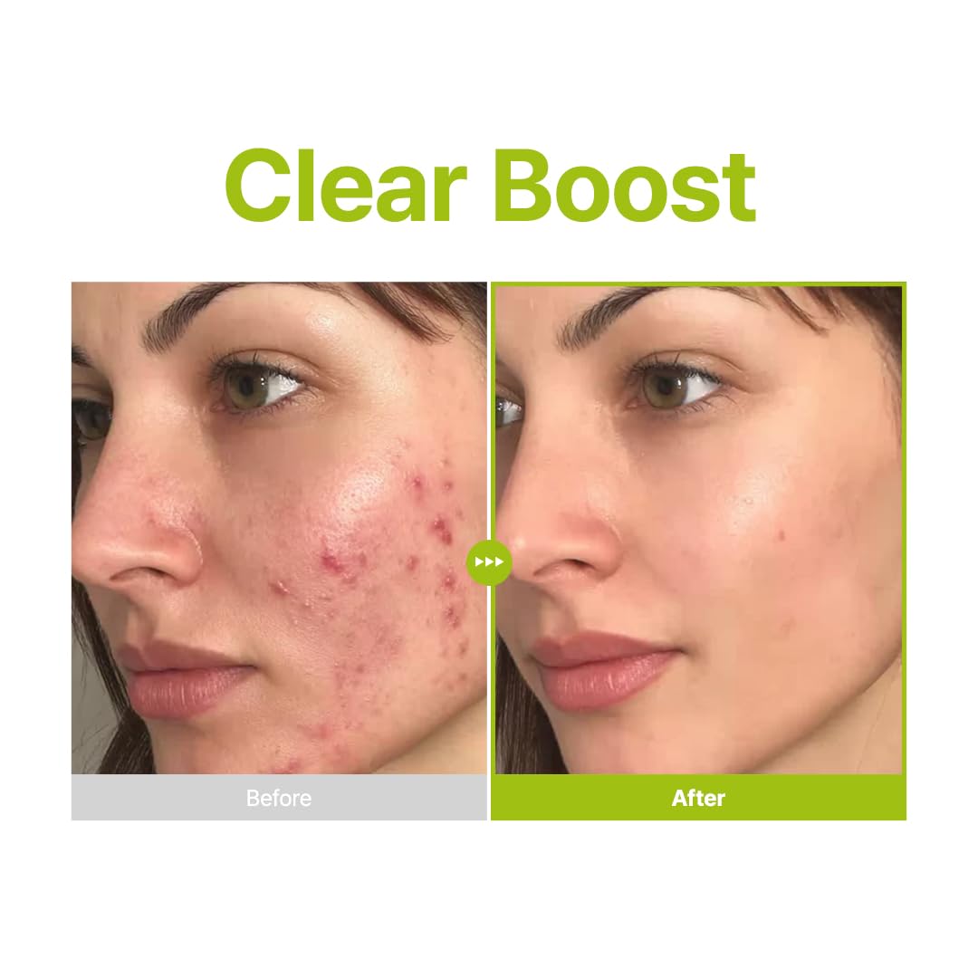 Purito Azelaic Acid 10 Kojic Azulene Serum 30 ml
