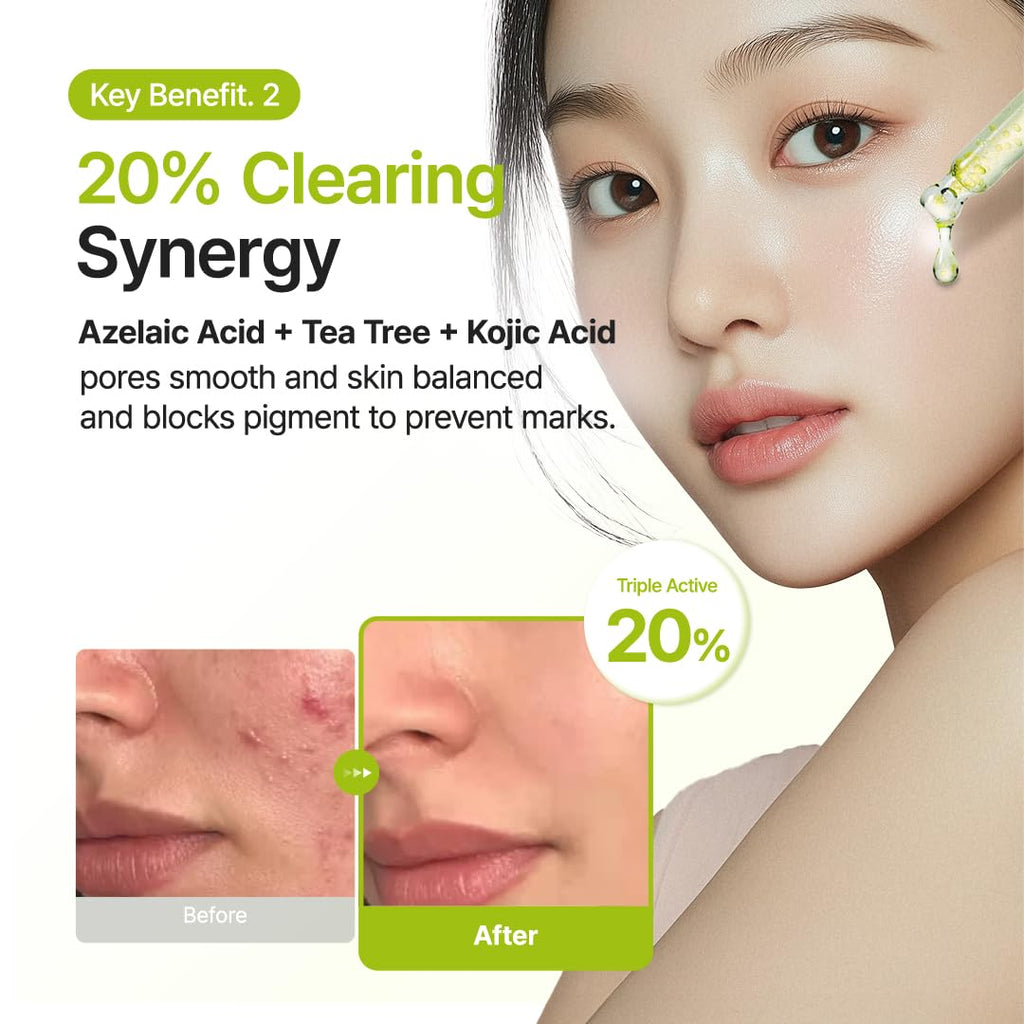 Purito Azelaic Acid 10 Kojic Azulene Serum 30 ml