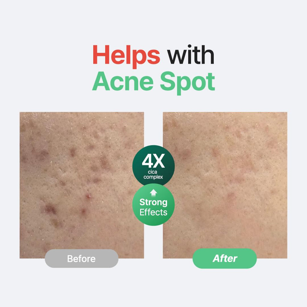 Purito Wonder Releaf Centella Serum Unscented 2.02 oz / 60 ml