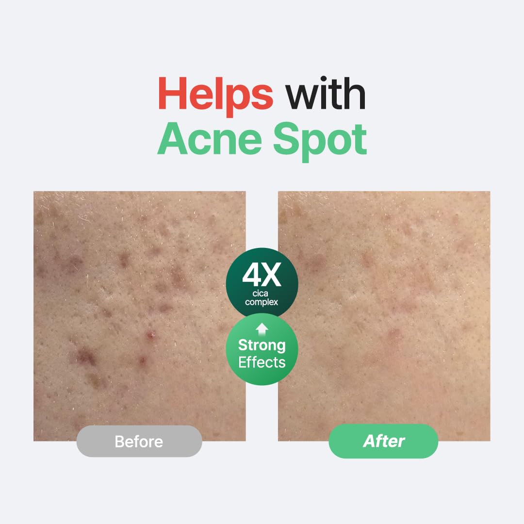 Purito Wonder Releaf Centella Serum Unscented 2.02 oz / 60 ml