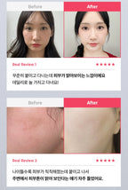 RingTap Glutathione Patch for Radiant & Clear Skin (20 Parches)