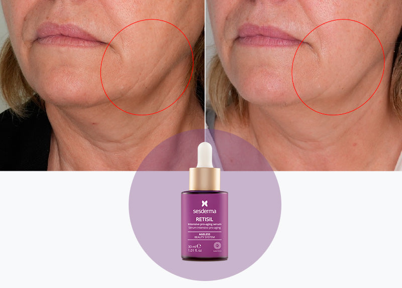 Sesderma Retisil Intensive Pro-Aging Serum 30 ml / 1.01 oz