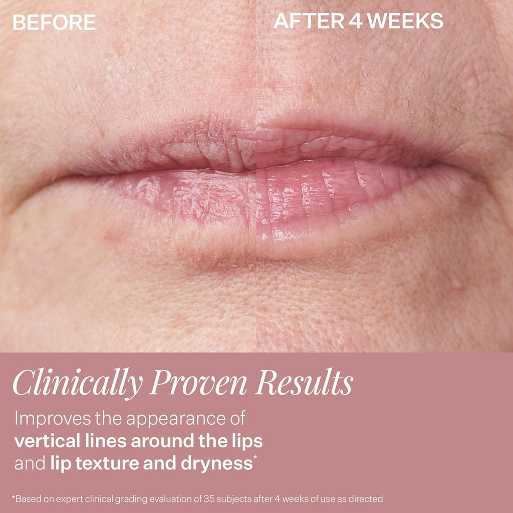 StriVectin Double Fix for Lips Plumping & Vertical Line Treatment 0.16 oz