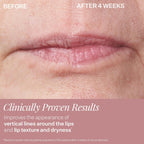 StriVectin Double Fix for Lips Plumping & Vertical Line Treatment 0.16 oz