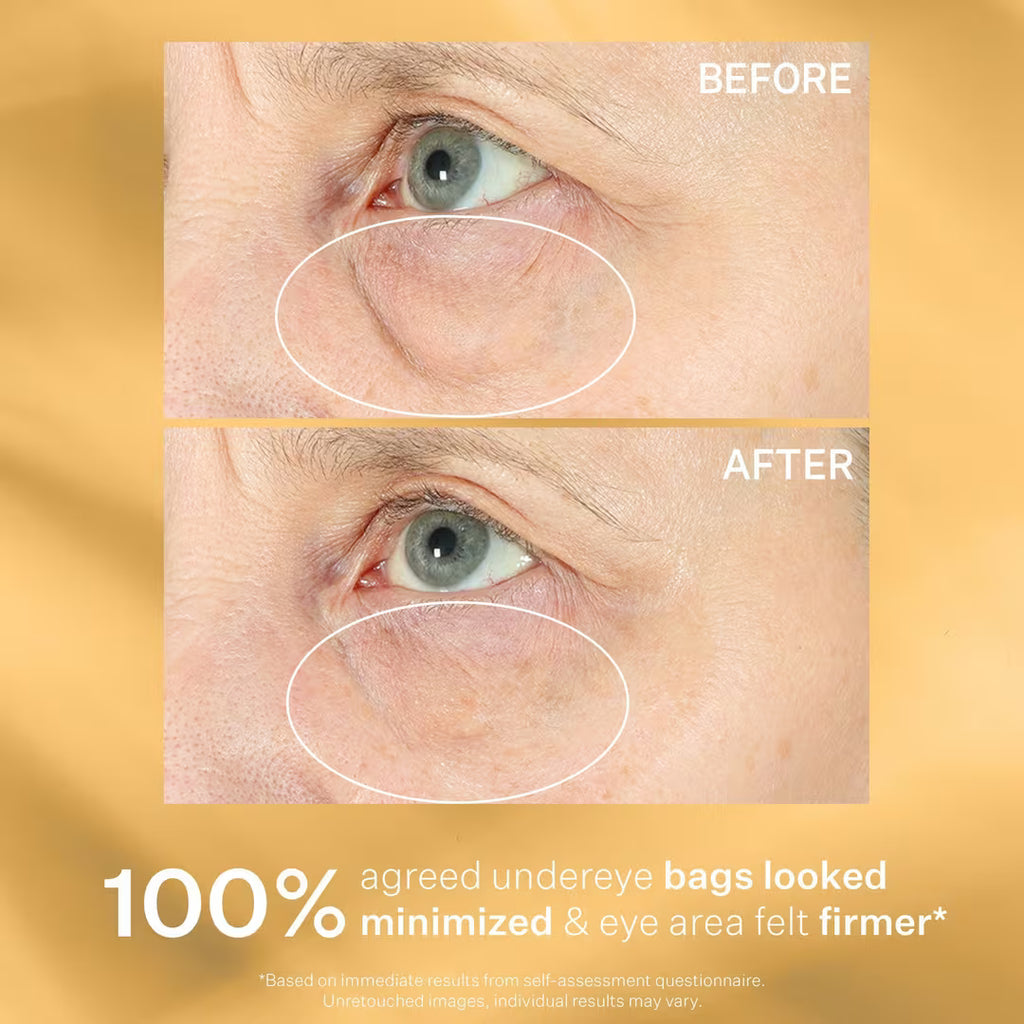 StriVectin Hyperlift Eye Instant Eye Fix For Bags, Lines & Crepiness 10 ml / 0.34 oz