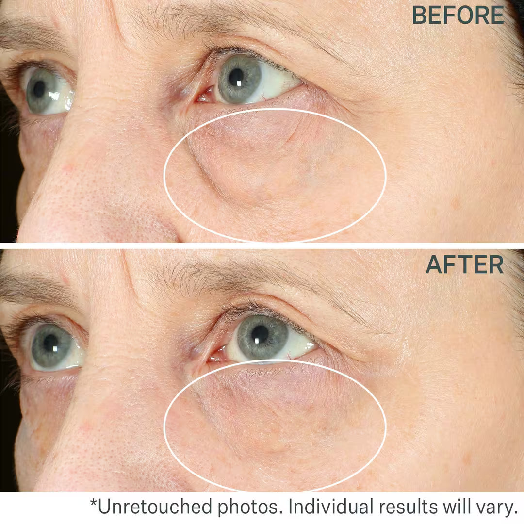 StriVectin Hyperlift Eye Instant Eye Fix For Bags, Lines & Crepiness 10 ml / 0.34 oz