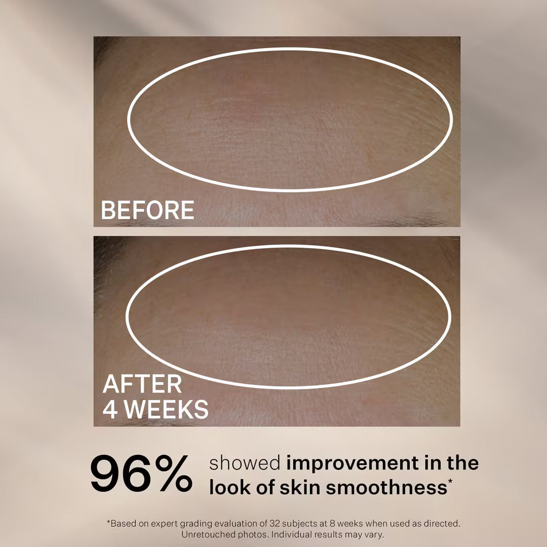 StriVectin Anti-Wrinkle Peptide Plump Line Filling Bounce Serum 30 ml / 1.0 oz