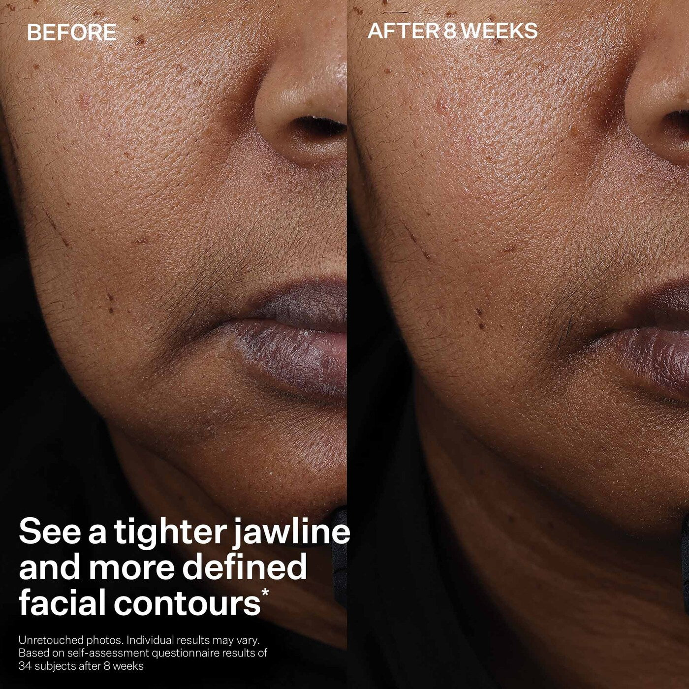 StriVectin Peptight Face Lift Serum 30 ml / 1.0 oz