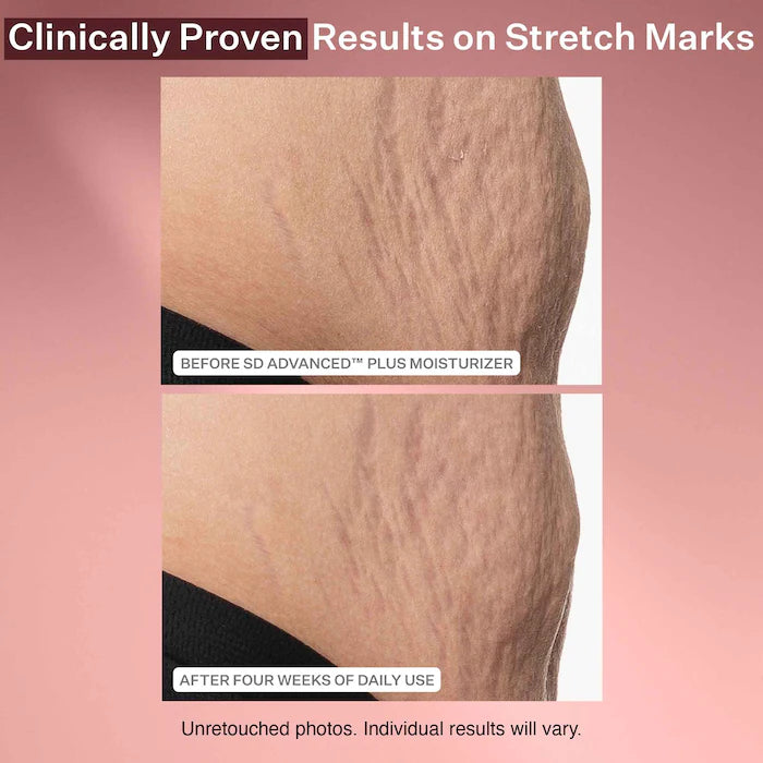 StriVectin SD Advanced Plus Intensive Moisturizer for Wrinkles & Stretch Marks Trial Size 10 ml