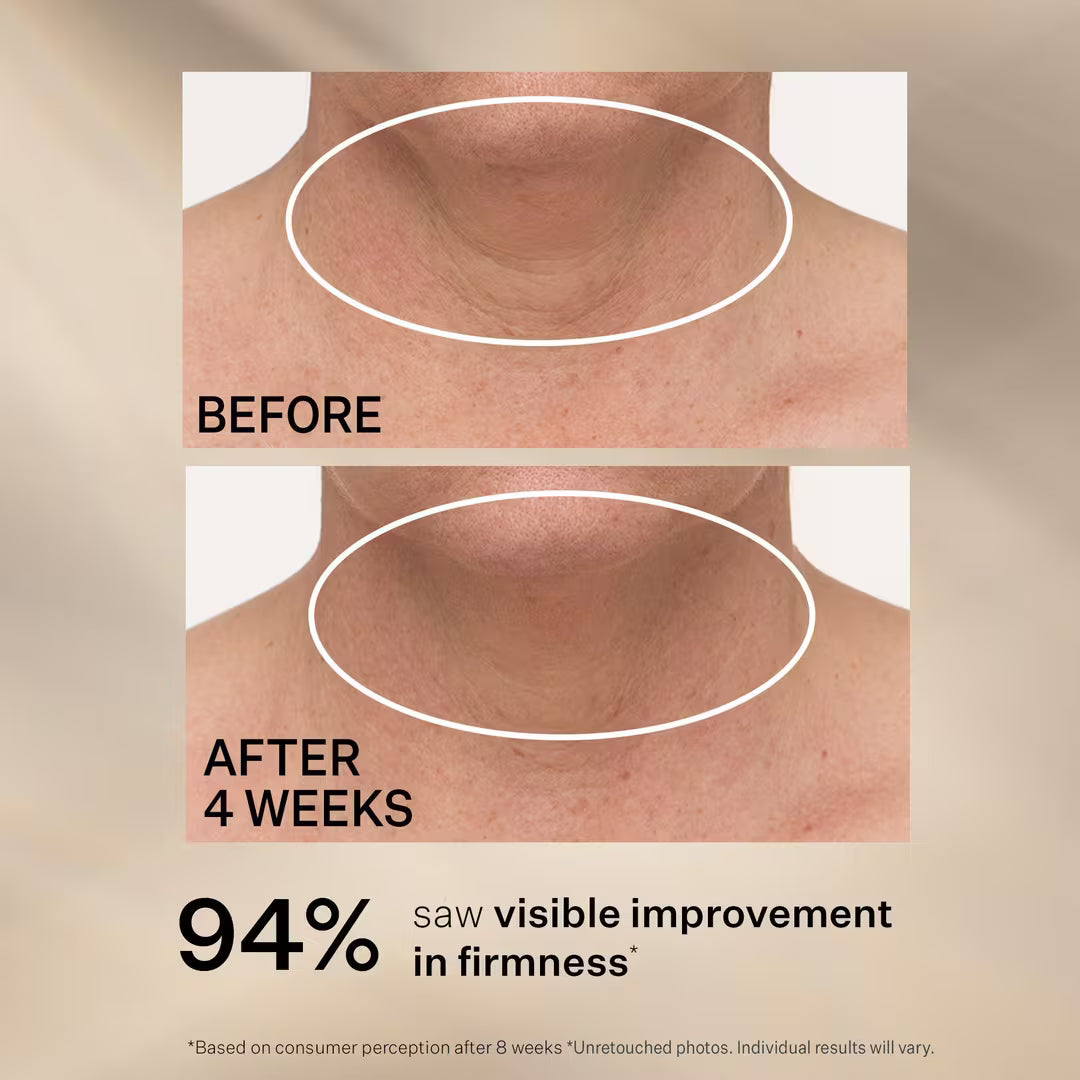 StriVectin TL Advanced Tightening Neck Cream Plus Jumbo 100 ml / 3.4 oz