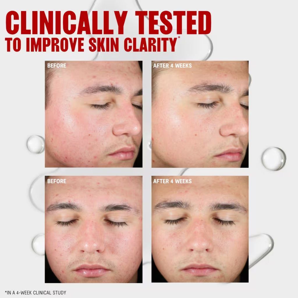 Thayers Blemish Clearing 2% BHA Toner Salicylic Acid Mini 1 oz / 30 ml