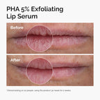The Ordinary PHA 5% Exfoliating Lip Serum 15 ml / 0.5 oz