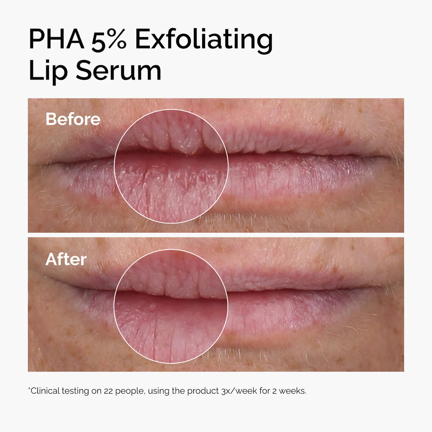 The Ordinary PHA 5% Exfoliating Lip Serum 15 ml / 0.5 oz