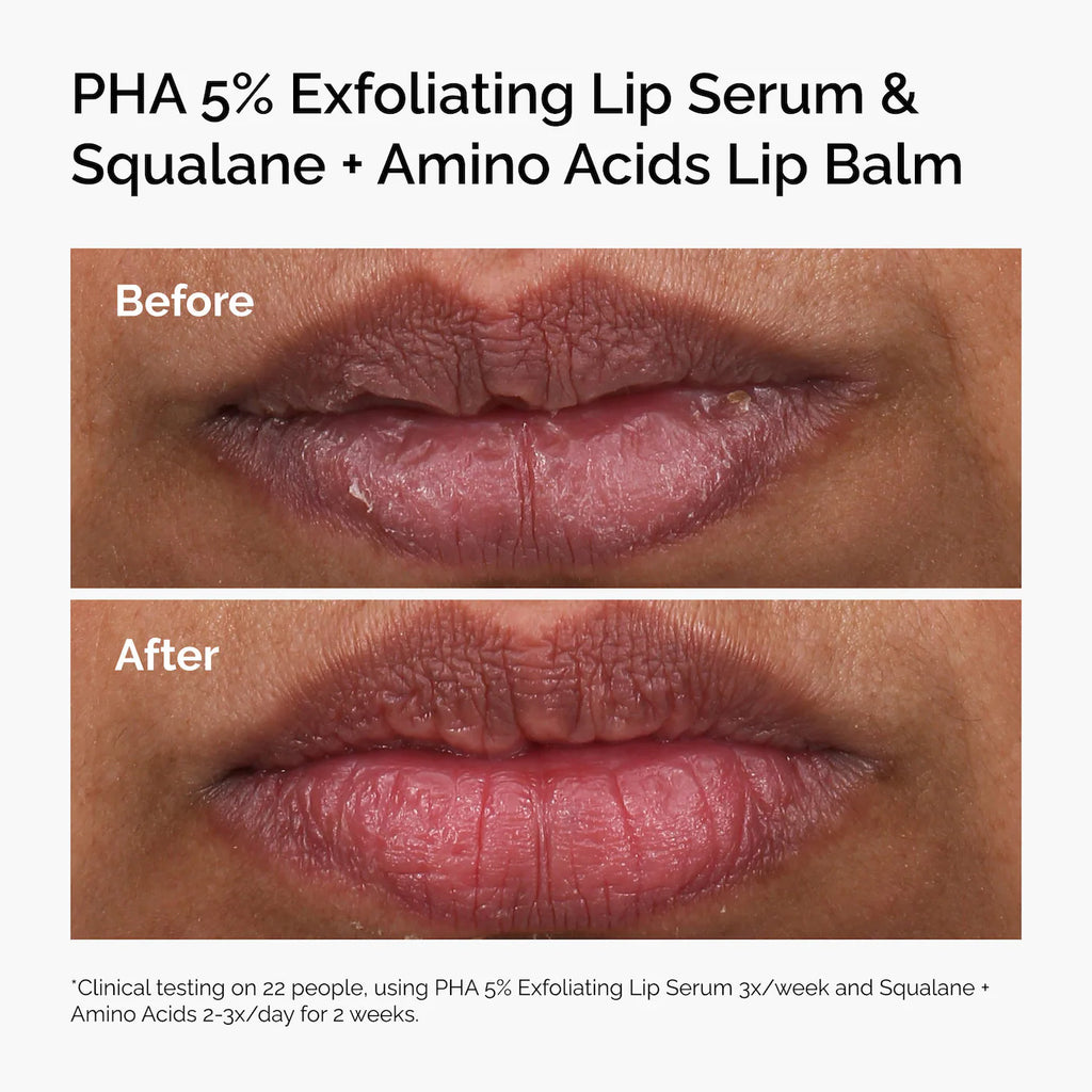 The Ordinary PHA 5% Exfoliating Lip Serum 15 ml / 0.5 oz