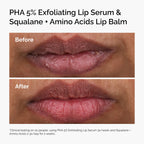 The Ordinary PHA 5% Exfoliating Lip Serum 15 ml / 0.5 oz