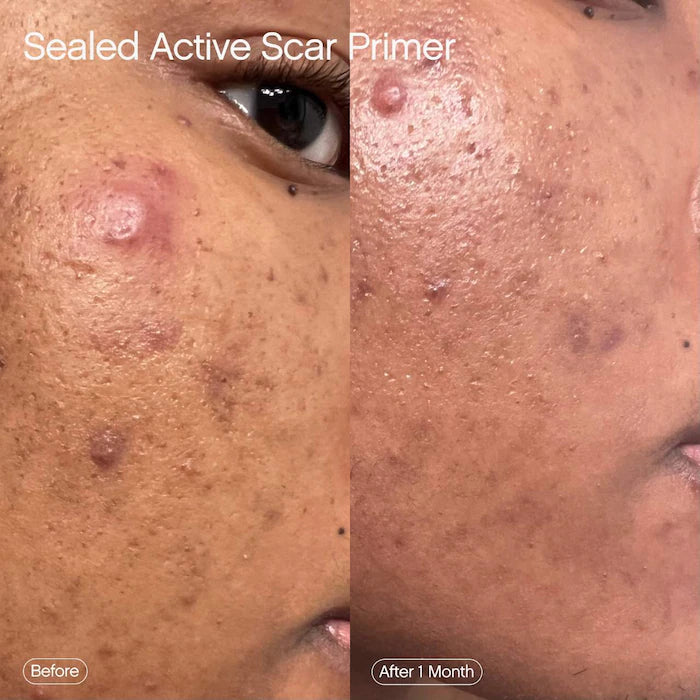 Topicals Sealed Active Scar Primer 28 ml