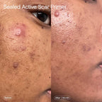 Topicals Sealed Active Scar Primer 28 ml