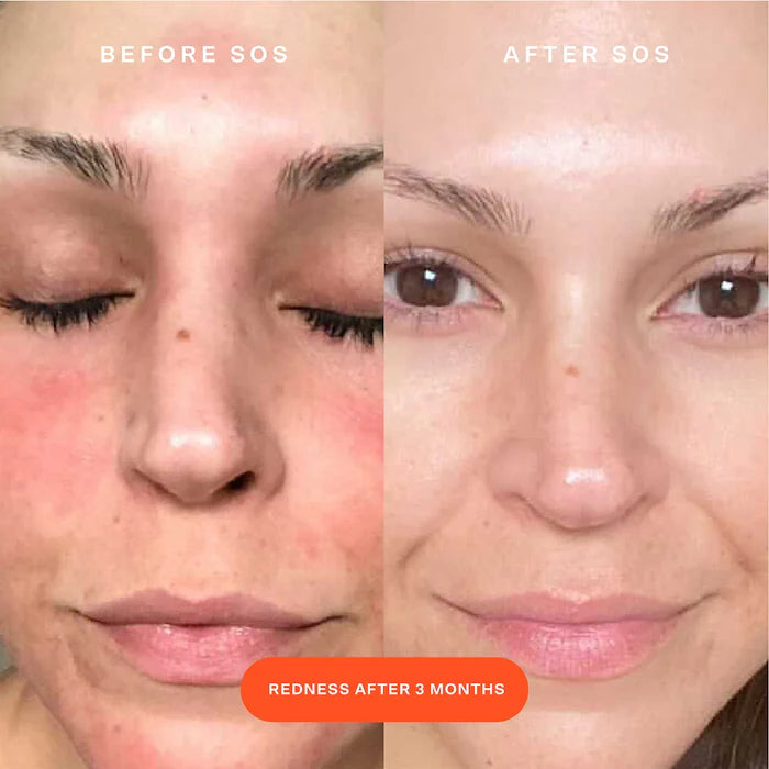 Tower 28 SOS Daily Rescue Facial Spray Mini 30 ml