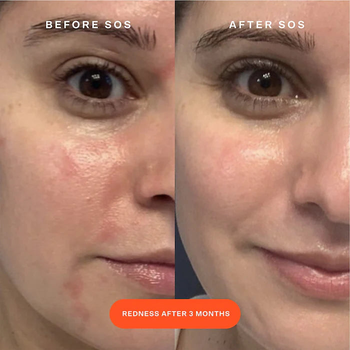 Tower 28 SOS Daily Rescue Facial Spray Mini 30 ml