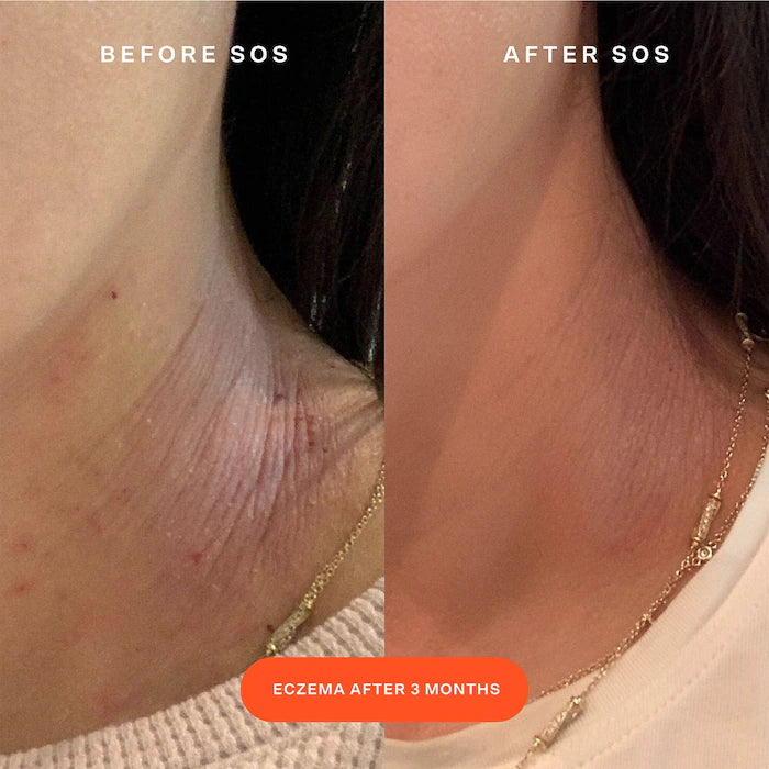 Tower 28 SOS Daily Rescue Facial Spray Mini 30 ml