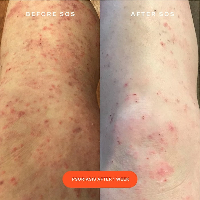 Tower 28 SOS Daily Rescue Facial Spray Mini 30 ml