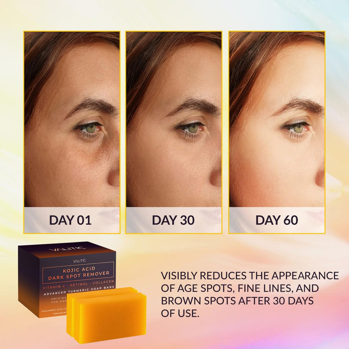 Valitic Kojic Acid Dark Spot Remover Soap Bars 2-Pack