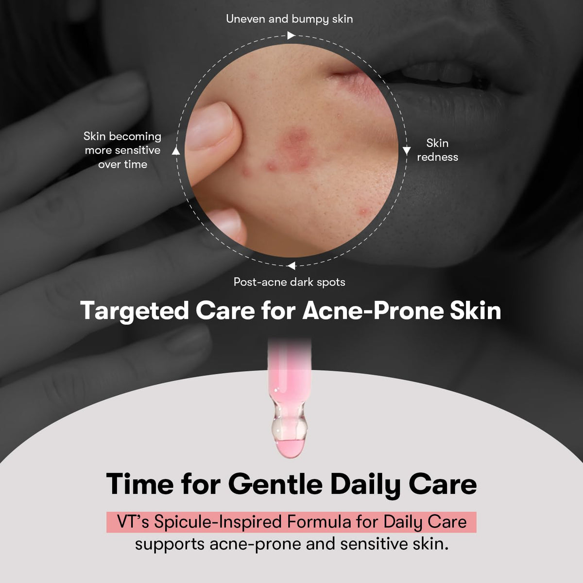 VT Cosmetics Azelaic Acid Cica Exosome Ampoule 30 ml / 1.01 oz