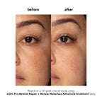 Boscia 0.6% Pro-Retinol Repair + Renew Waterless Advanced Treatment 30 ml