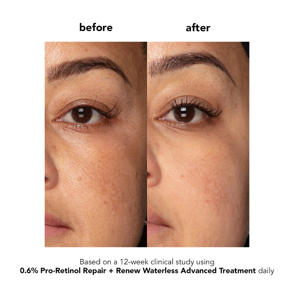 Boscia 0.6% Pro-Retinol Repair + Renew Waterless Advanced Treatment 30 ml