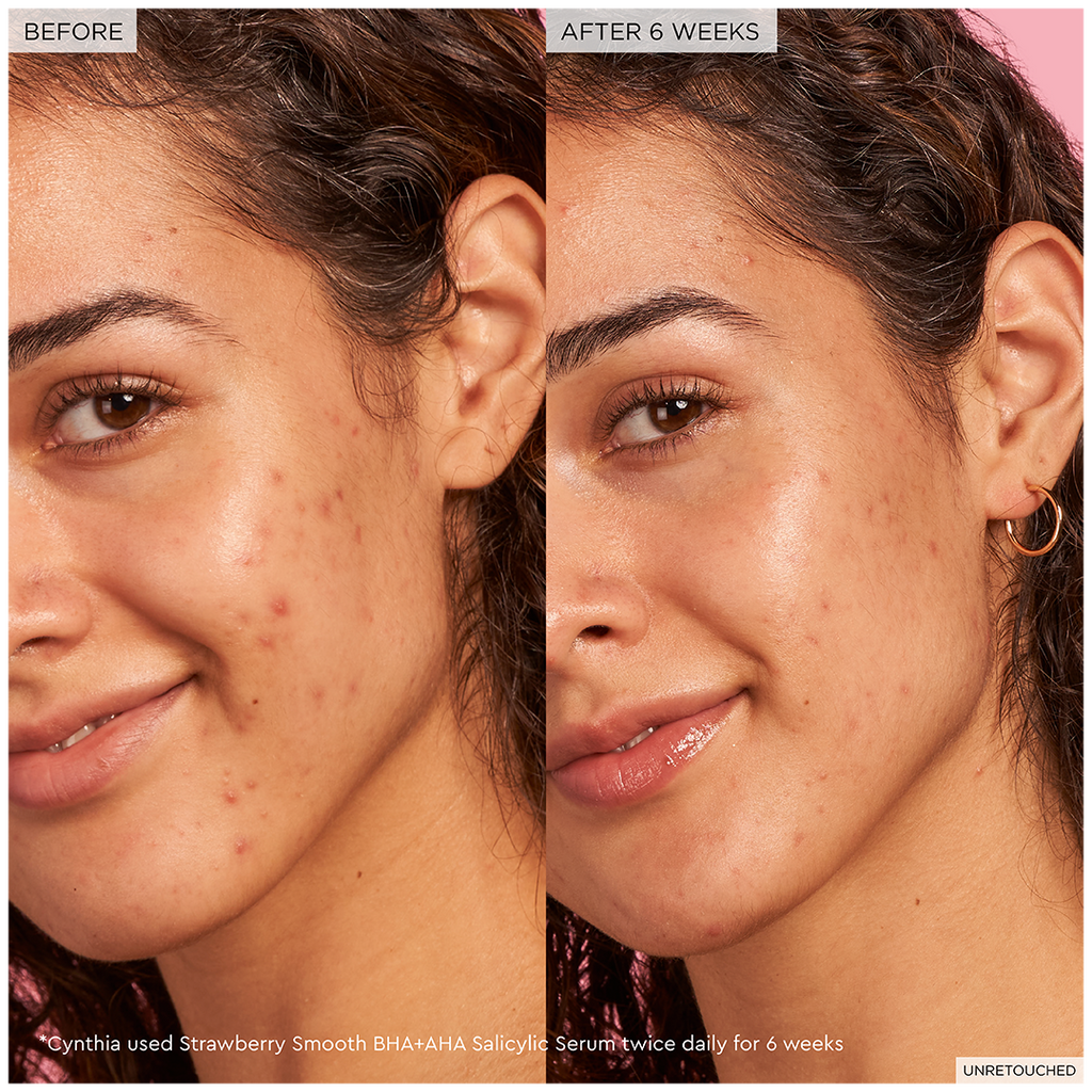 Glow Recipe Strawberry Smooth BHA + AHA Salicylic Acid Serum 30 ml