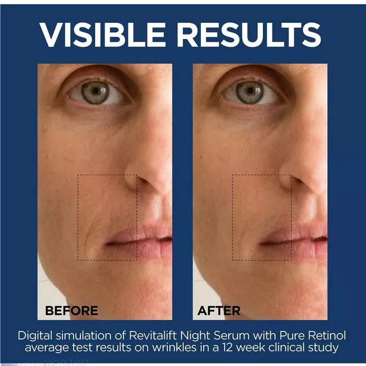 L'Oréal Revitalift Night Serum With Pure Retinol 30 ml