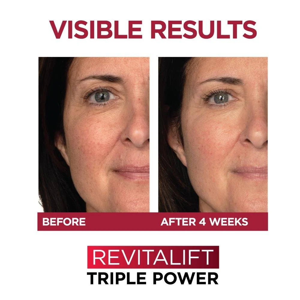 L'Oréal Revitalift Triple Power Anti-Aging Moisturizer Fragrance Free 48 g / 1.7 oz