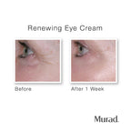 Murad Renewing Eye Cream 15 ml