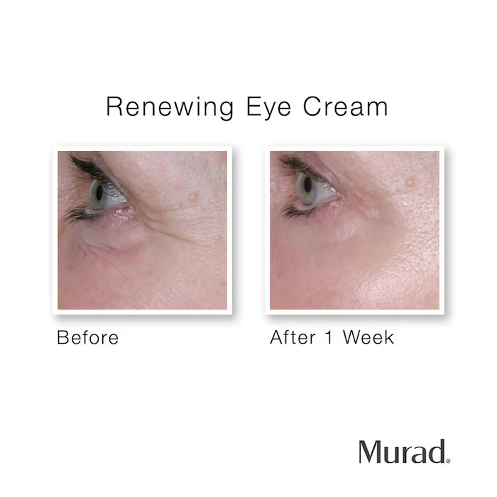 Murad Renewing Eye Cream 15 ml