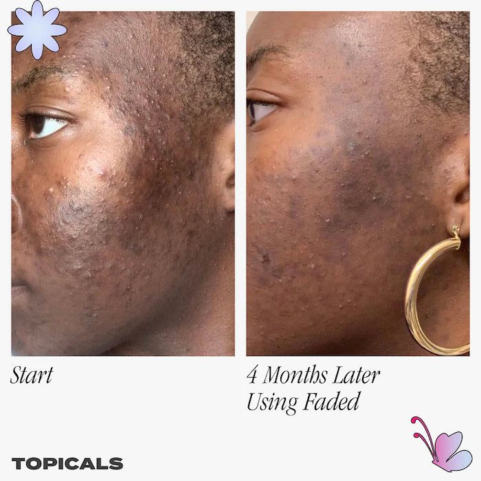 Topicals Faded Brightening & Clearing Serum Unscented 30 ml / 1 oz